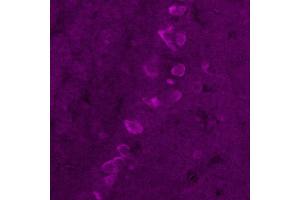 Immunohistochemistry (IHC) image for anti-Corticotropin Releasing Hormone (CRH) antibody (ABIN7456207) (CRH anticorps)