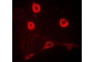 Immunofluorescent analysis of CD212 staining in MCF7 cells. (IL12RB1 anticorps)