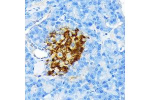 Immunohistochemistry of paraffin-embedded rat pancreatic islet using Insulin Rabbit mAb (ABIN7267886) at dilution of 1:100 (40x lens).