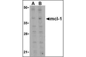Western blot analysis of Mcl-1 in Raji cell lysates with this product at (A) 1 and (B) 2 μg/ml. (MCL-1 anticorps  (C-Term))