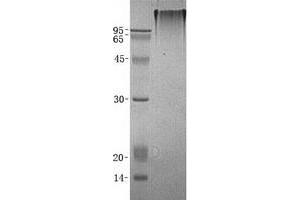Validation with Western Blot