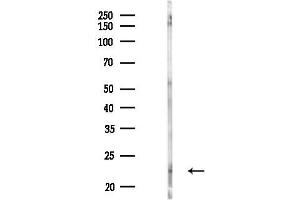 anti-Ciliary Neurotrophic Factor (CNTF) (C-Term) antibody