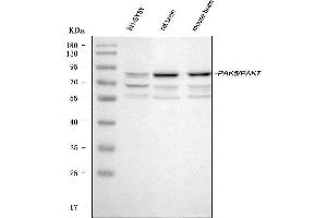 Western blot analysis of PAK5 using anti-PAK5 antibody (ABIN3043895). (PAK7 anticorps  (N-Term))
