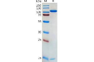 Human P Protein, hFc Tag on SDS-PAGE under reducing condition.