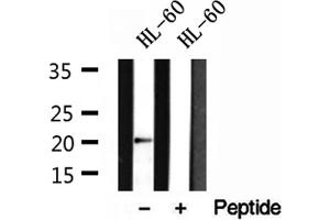 Western blot analysis of extracts of HL-60 cells, using Centrin 1 antibody. (Centrin 1 anticorps  (Internal Region))