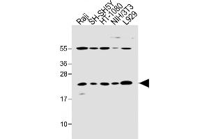 All lanes : Anti-Bax Antibody (BH3 Domain Specific) at 1:2000 dilution Lane 1: Raji whole cell lysate Lane 2: SH-SH5Y whole cell lysate Lane 3: HT-1080 whole cell lysate Lane 4: NIH/3T3 whole cell lysate Lane 5:  whole cell lysate Lysates/proteins at 20 μg per lane. (BAX anticorps  (AA 41-76))