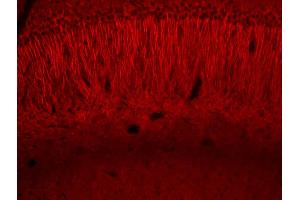 Generously provided by Merlin Levine from National Institutes of Health as part of the Bioss Discovery Program.