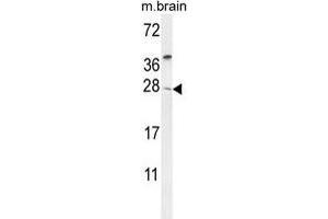 TIMP4 Antibody (Center) western blot analysis in mouse brain tissue lysates (35 µg/lane). (TIMP4 anticorps  (Middle Region))