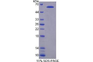 Image no. 1 for Protein Inhibitor of Activated STAT, 3 (PIAS3) (AA 11-280) protein (His tag,GST tag) (ABIN6237353)