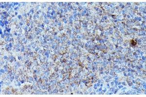 Immunohistochemistry of paraffin-embedded Rat spleen using CSF3 Polyclonal Antibody at dilution of 1:100 (40x lens). (G-CSF anticorps)