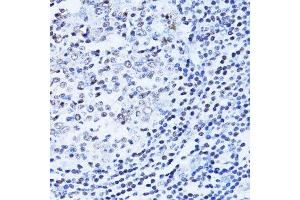 Immunohistochemistry of paraffin-embedded human appendix using PARP1 antibody.