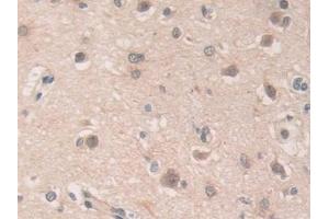 anti-Ubiquitin Specific Peptidase 7 (Herpes Virus-Associated) (USP7) (AA 54-507) antibody