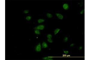Immunofluorescence of monoclonal antibody to CDK5RAP3 on HeLa cell.