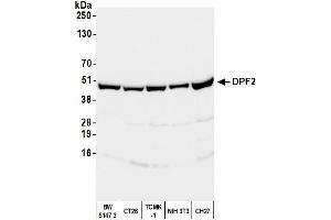 anti-Zinc finger protein ubi-d4 (DPF2) (AA 125-175) antibody