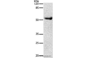 Western blot analysis of Human liver cancer tissue, using DRD4 Polyclonal Antibody at dilution of 1:600