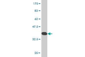 Western Blot detection against Immunogen (37.