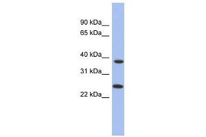 MTRF1L antibody used at 1 ug/ml to detect target protein. (MTRF1L anticorps  (N-Term))
