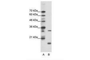 Image no. 1 for anti-MYC Associated Factor X (MAX) (C-Term) antibody (ABIN203016) (MAX anticorps  (C-Term))