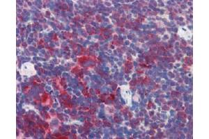 IHC Image for AP22588PU-N Mouse Spleen (formalin-fixed, paraffin-embedded) stained with M6PRBP1followed by biotinylated anti-goat IgG secondary antibody LS-D3, alkaline phosphatase-streptavidin and chromogen. (PLIN3 anticorps  (Internal Region))