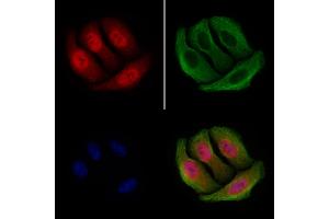 ABIN6255391 and ABIN6267252 staining Hela cells(4h of LPS treatment) by IF/ICC. (CHEK2 anticorps  (pSer516))