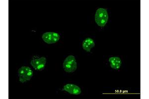 Immunofluorescence of monoclonal antibody to FBL on HeLa cell. (Fibrillarin anticorps  (AA 1-321))