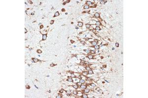 Immunohistochemistry of paraffin-embedded rat brain using LM Rabbit mAb (ABIN7268205) at dilution of 1:100 (40x lens). (LMAN1 anticorps)