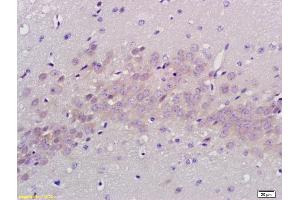 Formalin-fixed and paraffin embedded rat brain labeled with Anti PABP Polyclonal Antibody, Unconjugated (ABIN704786) at 1:200 followed by conjugation to the secondary antibody and DAB staining (PABP anticorps  (AA 101-200))
