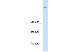WB Suggested Anti-NRCAM Antibody Titration:  2. (NrCAM anticorps  (N-Term))