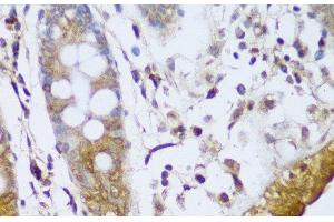 Immunohistochemistry of paraffin-embedded Human colon using GCC2 Polyclonal Antibody at dilution of 1:150 (40x lens). (GCC2 anticorps)