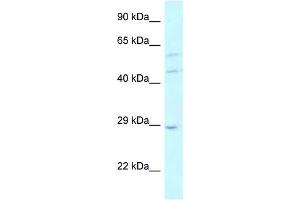 LSM14A antibody used at 1 ug/ml to detect target protein. (LSM14A anticorps)