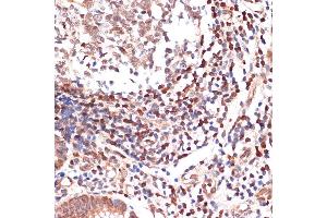 Immunohistochemistry of paraffin-embedded human appendix using  Rabbit mAb (ABIN3016894, ABIN3016895, ABIN3016896, ABIN1679361 and ABIN1679362) at dilution of 1:100 (40x lens).