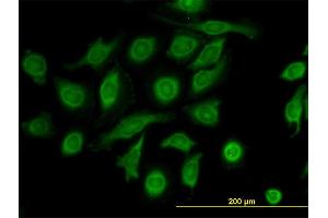 Immunofluorescence of monoclonal antibody to TIMP2 on HeLa cell. (TIMP2 anticorps  (AA 27-220))