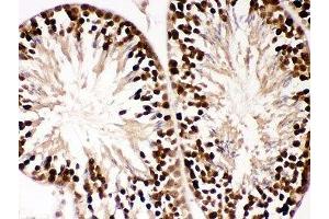 IHC-P: PBK antibody testing of mouse testis tissue (PBK anticorps  (AA 71-322))