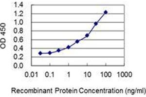 Detection limit for recombinant GST tagged LSM3 is 0.