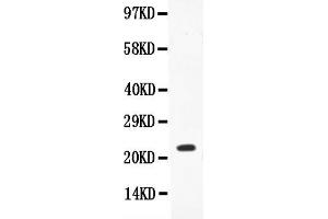 Anti-IL-18 Picoband antibody, All lanes: Anti-IL18  at 0. (IL-18 anticorps  (AA 37-193))