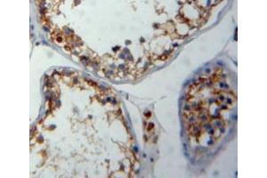 Used in DAB staining on fromalin fixed paraffin-embedded testis tissue