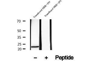 Western blot analysis of extracts of MCF-7 cells, using HBXIP antibody. (HBXIP anticorps  (Internal Region))