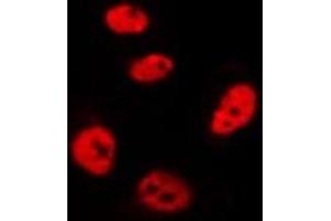 ABIN6275797 staining Hela by IF/ICC. (CHFR anticorps)