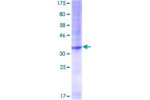 Image no. 1 for Protection of Telomeres 1 (POT1) (AA 1-95) protein (GST tag) (ABIN1315766)
