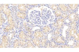 Detection of HLA-DRA in Human Kidney Tissue using Polyclonal Antibody to HLA Class II Histocompatibility Antigen, DR Alpha Chain (HLA-DRA) (HLA-DRA anticorps  (AA 27-216))