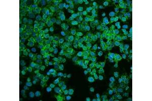 IF analysis of ASS1 using anti-ASS1 antibody (ABIN7601190).