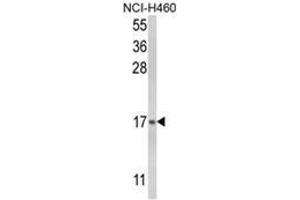 Western blot analysis of LTC4S Antibody
