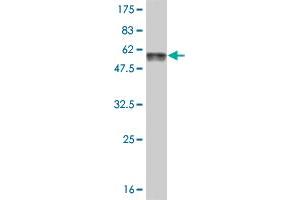 Western Blot detection against Immunogen (57. (AKTIP anticorps  (AA 1-292))