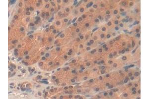 Detection of SEMA3A in Rat Stomach Tissue using Polyclonal Antibody to Semaphorin 3A (SEMA3A)