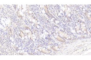Detection of PLA2G4 in Human Small intestine Tissue using Polyclonal Antibody to Cytosolic Phospholipase A2 (PLA2G4)