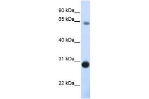 DERL3 antibody used at 1 ug/ml to detect target protein. (Derlin-3 anticorps  (C-Term))