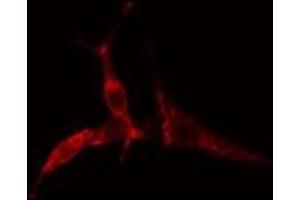 ABIN6275186 staining  COLO205 cells by IF/ICC. (HLA-DOA anticorps)