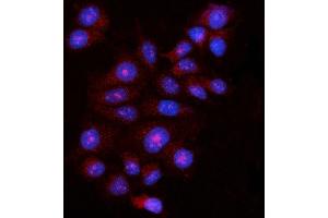 IF analysis of FBP1 using anti-FBP1 antibody (ABIN7599395).