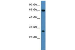 Image no. 1 for anti-Kelch Repeat and BTB (POZ) Domain Containing 8 (KBTBD8) (AA 63-112) antibody (ABIN6746791) (KBTBD8 anticorps  (AA 63-112))