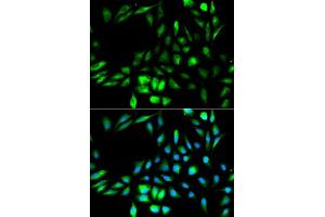 Immunofluorescence analysis of MCF-7 cells using KPNA2 antibody. (KPNA2 anticorps  (AA 1-290))